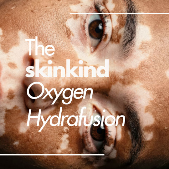 SkinKind Social Media work Oxygen Hydrafusion Skin Care- Coconut Sundays Creative